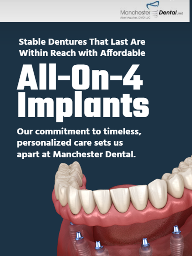 All-On-4 Implants